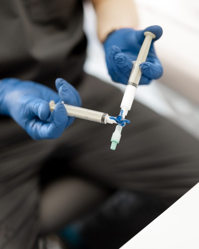 Phlebology,Doctor,Prepares,Special,Solution,In,Syringe,For,Sclerotherapy,,Close-up